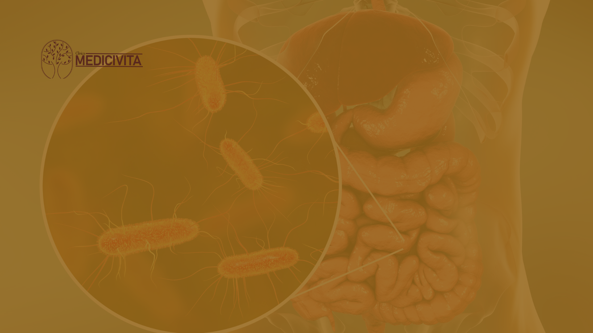 Inflamações intestinais: cuidado! Esses sintomas podem indicar problemas digestivos!